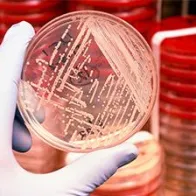 Antimicrobial resistance