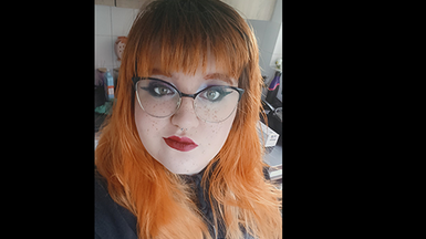 Michelle patient story